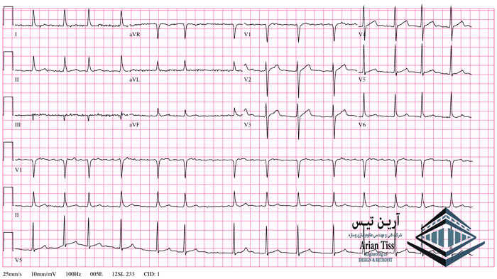 puls speed